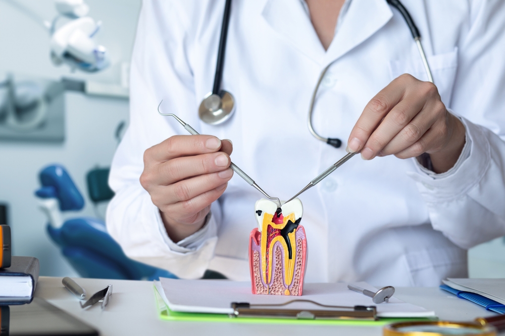 Showing a Model of a Damaged Tooth in a Dental Office.